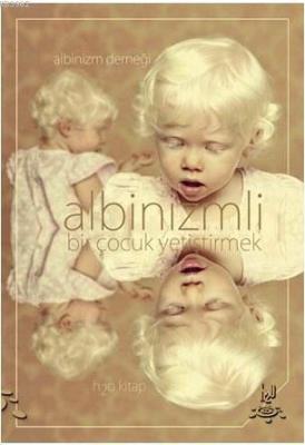 Albinizmli Bir Çocuk Yetiştirmek Kolektif