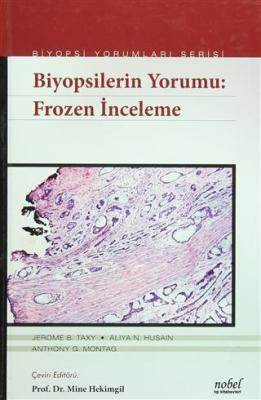 Biyopsilerin Yorumu: Frozen İnceleme