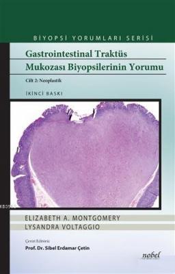 Gastrointestinal Traktüs Mukozası Biyopsilerinin Yorumu (Cilt 2 Neopla