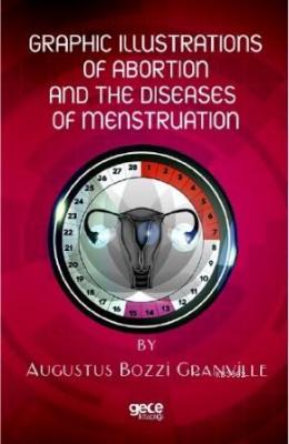 Graphic İllustrations Of Abortion And The Diseases Of Menstruation Aug